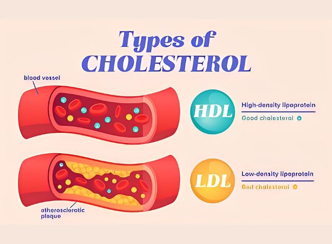 Can you live long with high cholesterol?